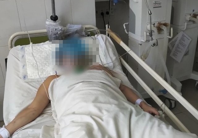 Nhap vien sau nhung chen ruou 'bat mang', bac si chi cach phong tranh hinh anh