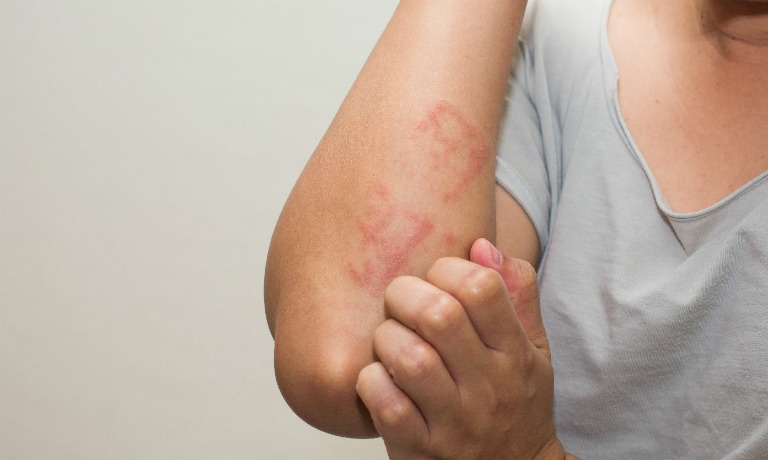 Dau hieu canh bao can di kham ky sinh trung hinh anh