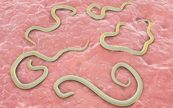 Dieu khong nen lam khi bi nhiem giun hinh anh