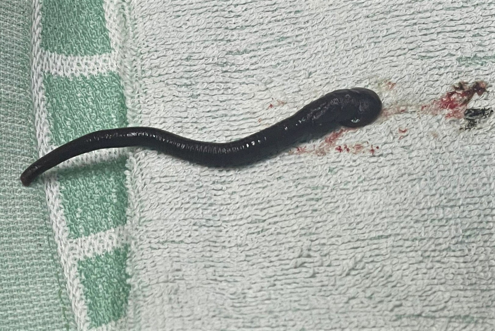 Con vat dai gan 7 cm song trong mui nguoi phu nu hinh anh