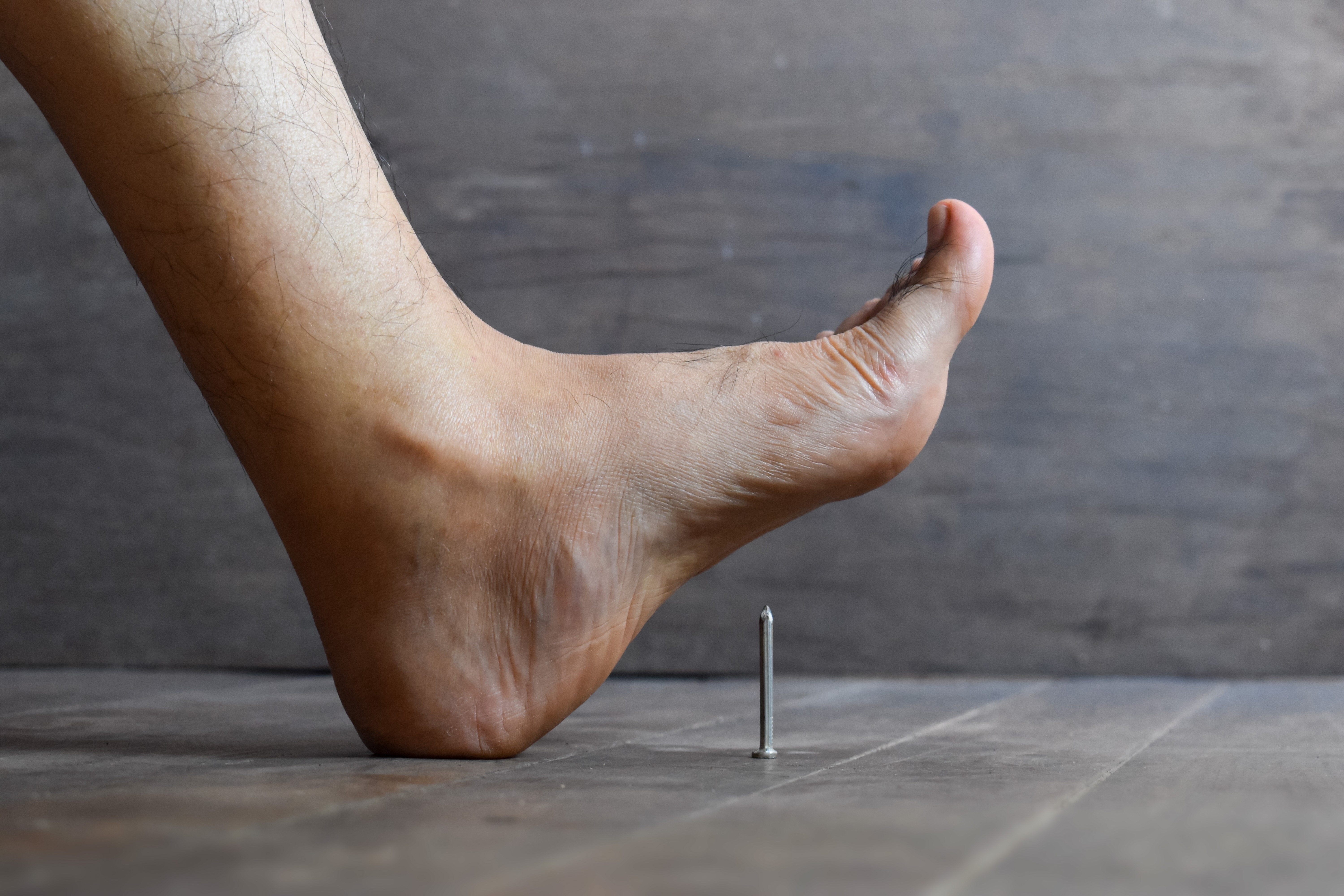 Ly do chung ta bi uon van khi giam phai vat nhon hinh anh