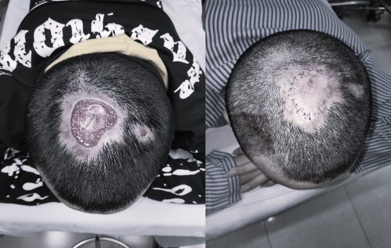 hong toc vi tay anh 3