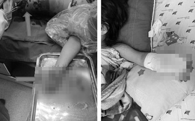 tai nan no phao anh 1