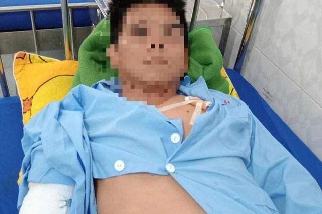 cho becgie can nguoi anh 1