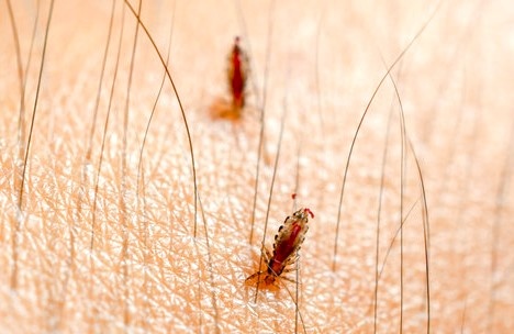 Hang tram con ran tren mi mat co gai 20 tuoi hinh anh