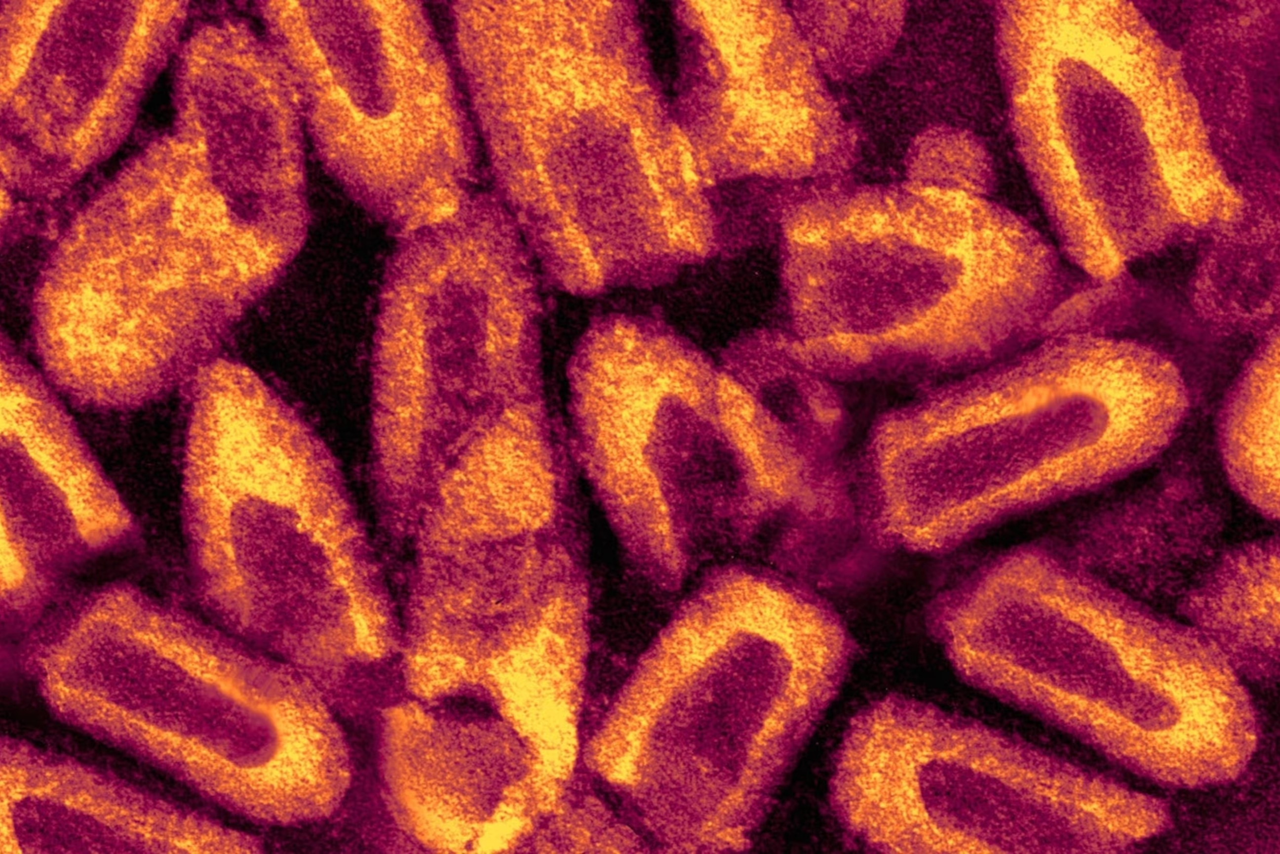 Loai virus nguy hiem u benh nhieu nam, cho thoi co bung phat hinh anh