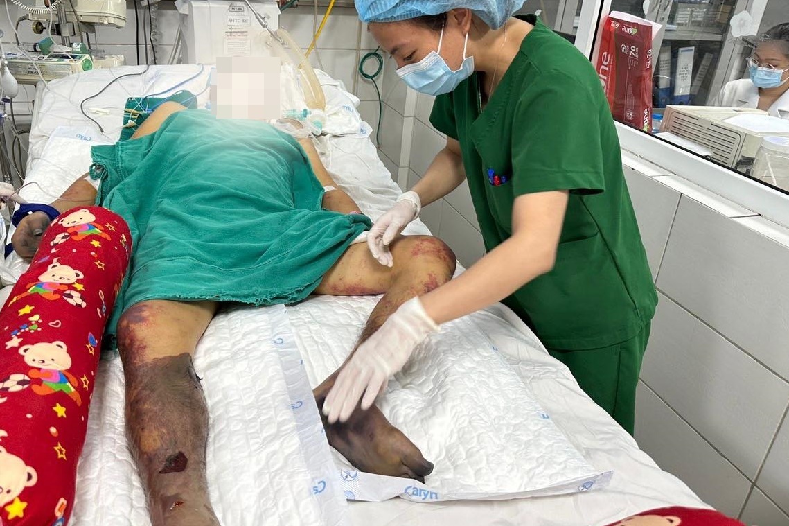 nhiem ky sinh trung anh 1