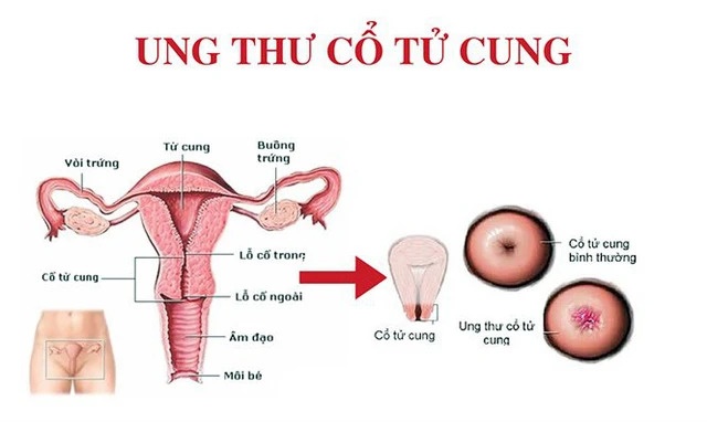 khi nao thu thai anh 1