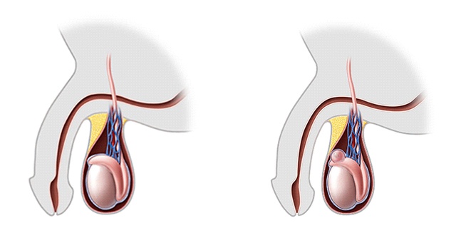 ly do dau tinh hoan anh 2