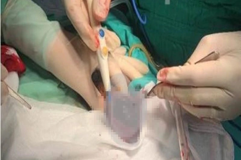 Nam thanh nien bi vo tinh hoan khi choi da bong hinh anh