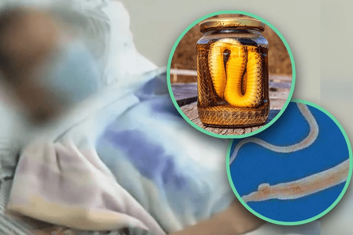 nhiem ky sinh trung anh 1