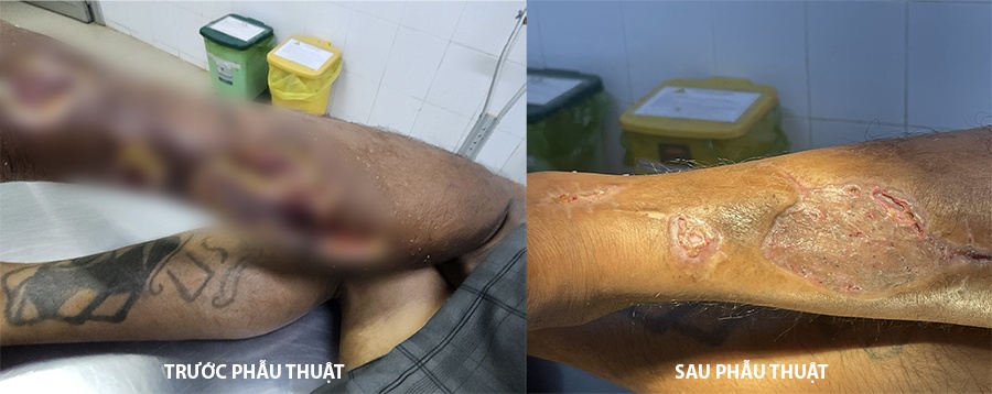 ran can hoai tu da anh 1