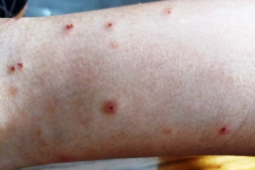 Ly do nhieu nguoi o Ha Tinh dot ngot noi man do da hinh anh