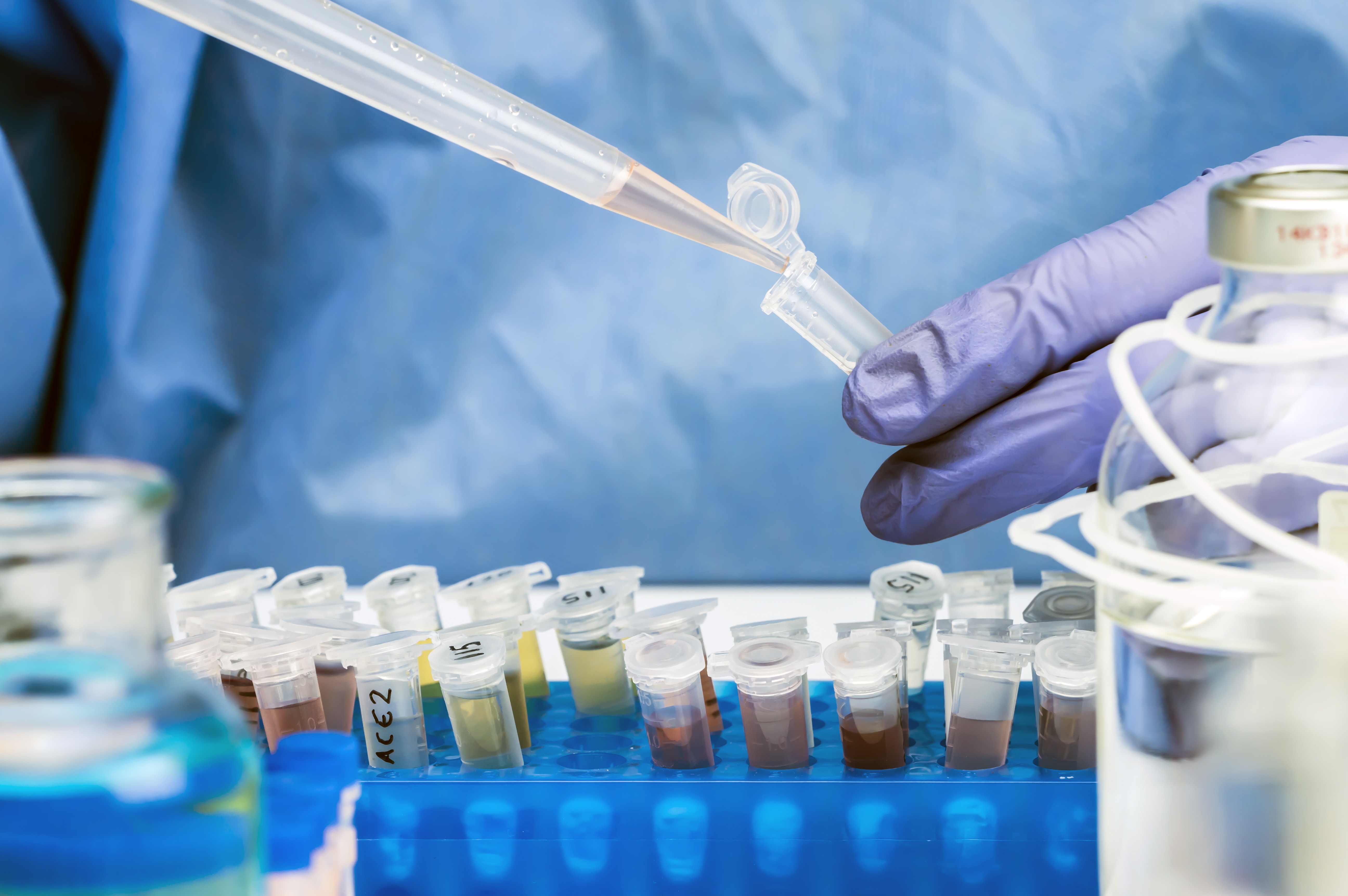 My nghi virus cum gia cam xuat hien trong nuoc thai hinh anh