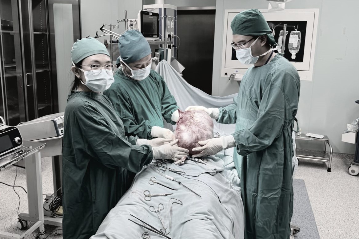 Khoi u khong lo trong co the be gai 12 tuoi hinh anh