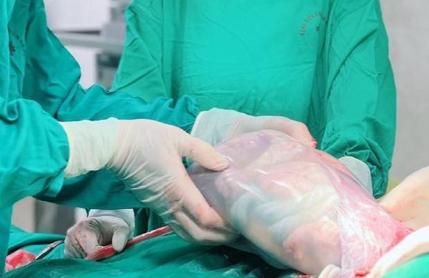 Em be chao doi trong boc dieu hiem gap hinh anh