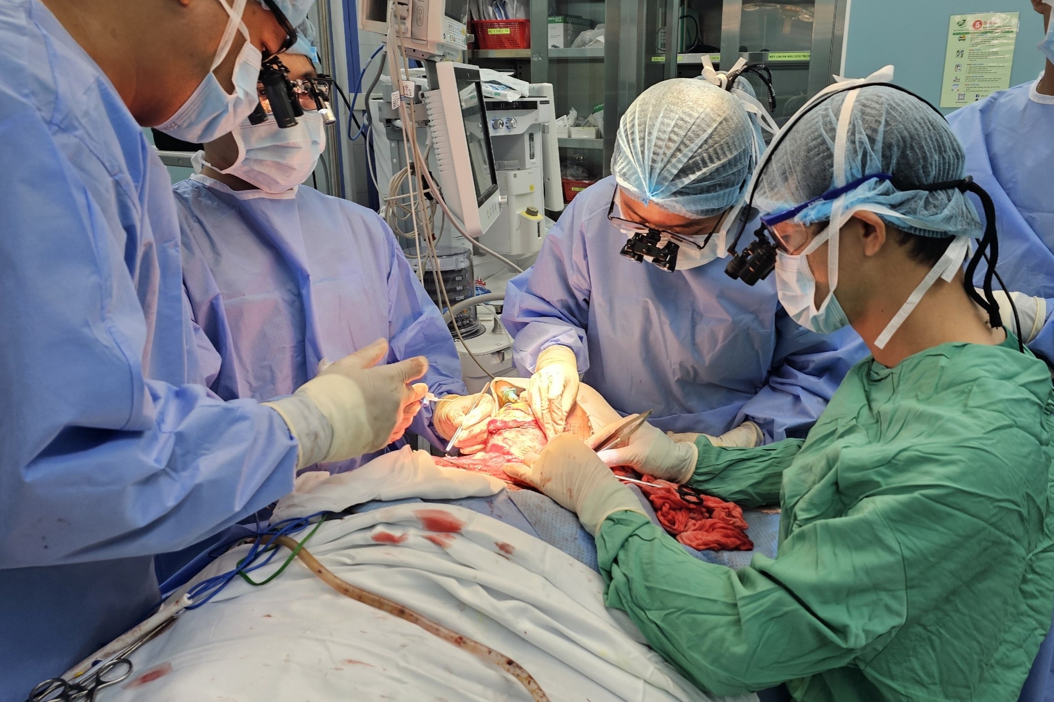 Cuu thanh nien 26 tuoi bi bong den bien dang co the hinh anh