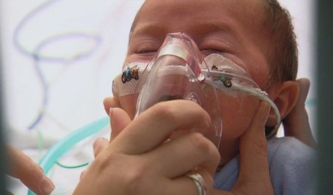 Diem chung cua da so ca benh ho ga tai TP.HCM hinh anh