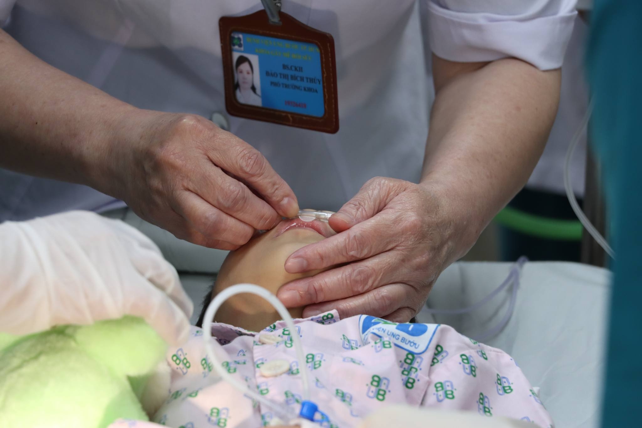 Be gai 3 tuoi mac ung thu vung kin hiem gap hinh anh