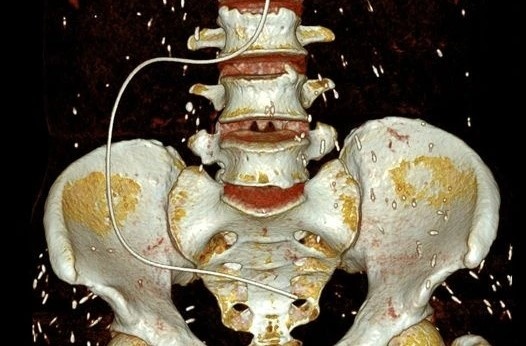 Hinh anh san ky sinh khap co the nguoi phu nu hinh anh