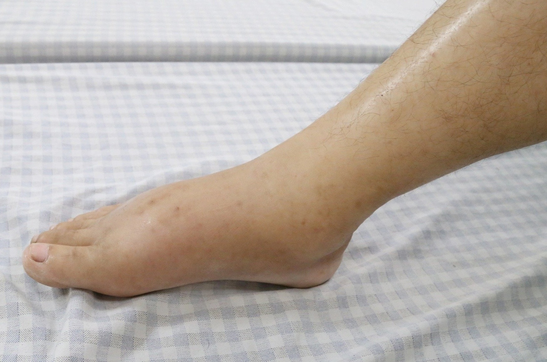 Than hu muc do nang o tuoi 30 vi dieu tri sai lam hinh anh