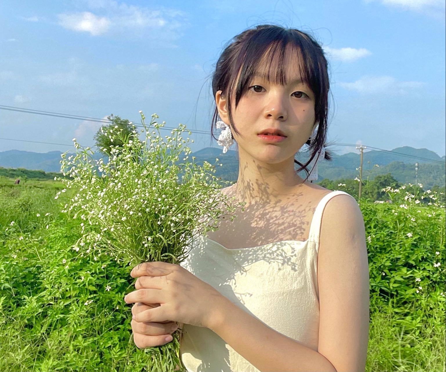 ung thu anh 2