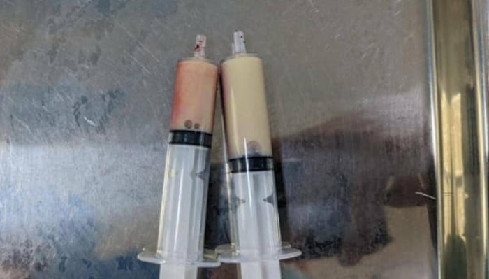 Nguoi dan ong di cap cuu voi con dau bung du doi hinh anh