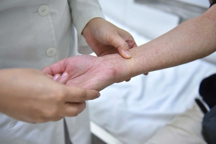 sốt xuất huyết ở TP.HCM ảnh 2 sot xuat huyet o TP.HCM anh 2