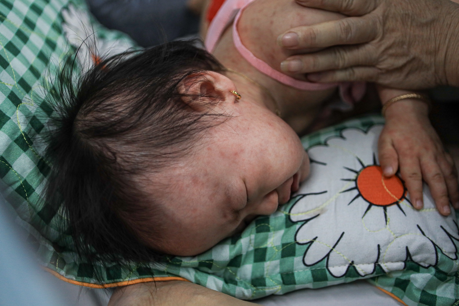 Be 9 tuoi nguy kich sau vai ngay sot phat ban hinh anh