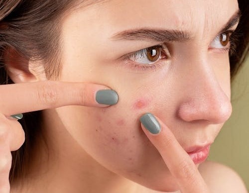 Thoi diem tuyet doi khong nen nan mun hinh anh