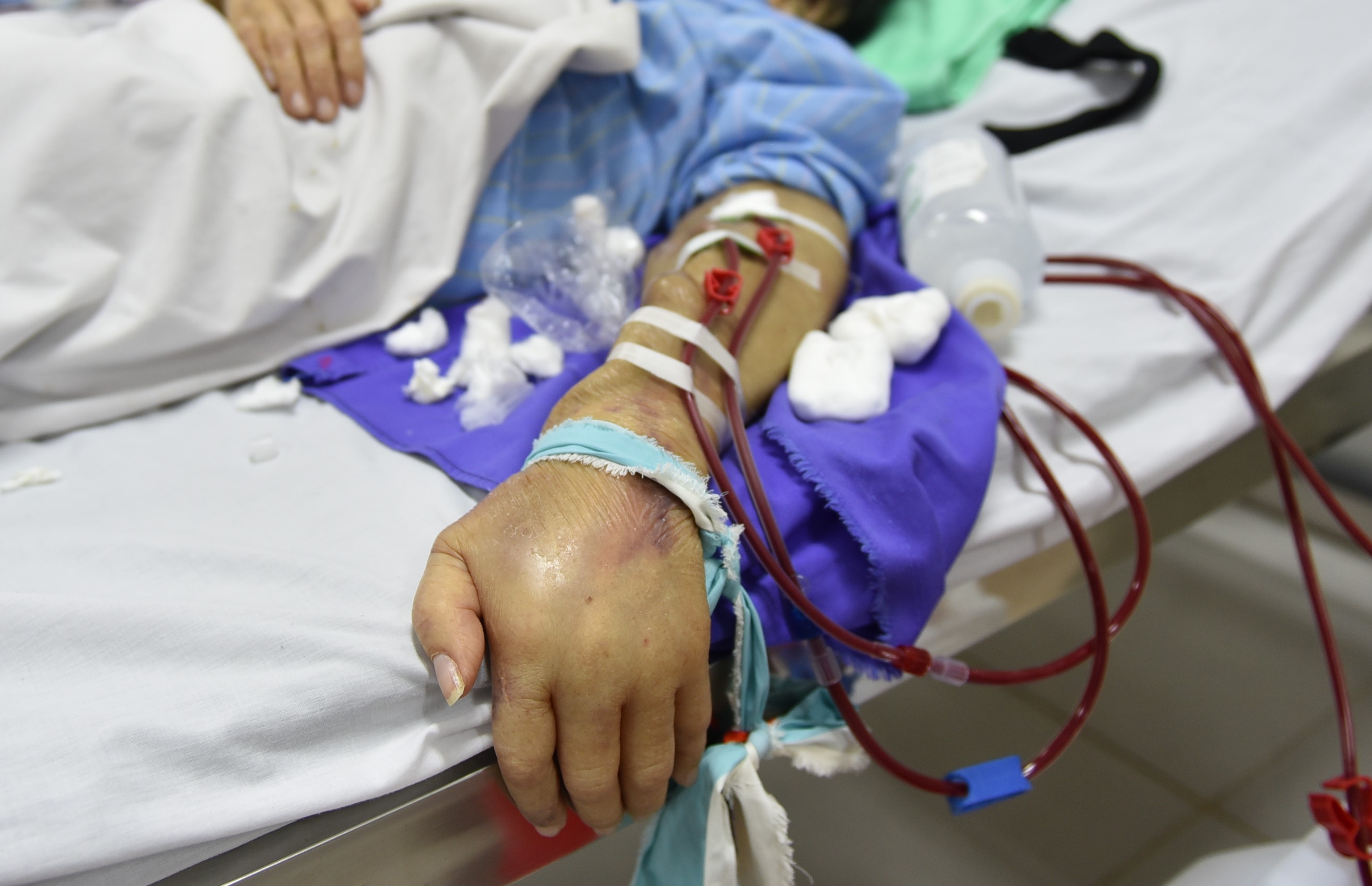 dau hieu suy than anh 1