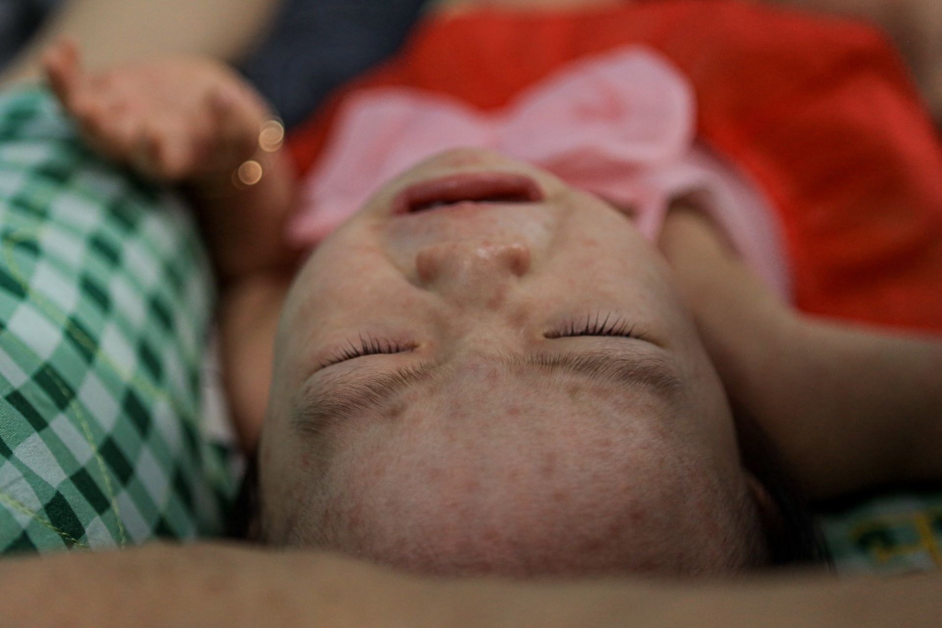 Hai benh truyen nhiem dang gia tang tai TP.HCM tuan qua hinh anh