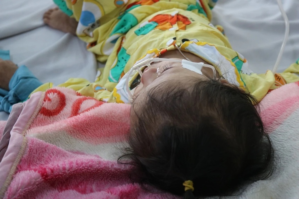 Dau hieu nguy hiem khi tre mac soi hinh anh