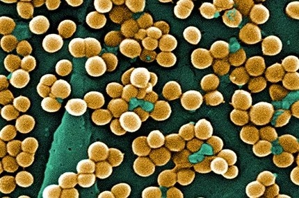 Loai vi khuan quen thuoc khien 70 nguoi nhap vien o Bac Kan hinh anh