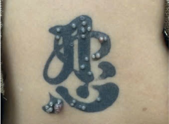 Nguoi phu nu di cap cuu sau khi xam o vi tri nhay cam hinh anh