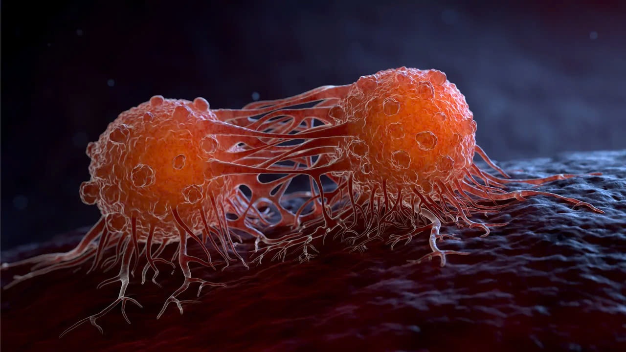 4 'thu pham' gay ung thu pho bien nhat hinh anh