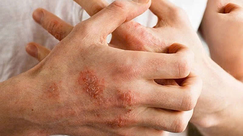 Cau hoi thuong gap lien quan den di ung thoi tiet hinh anh