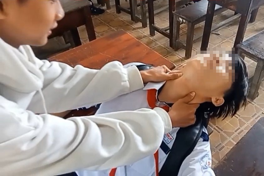 Hoc sinh thu 'bat pen', bac si canh bao hanh dong lieu linh hinh anh