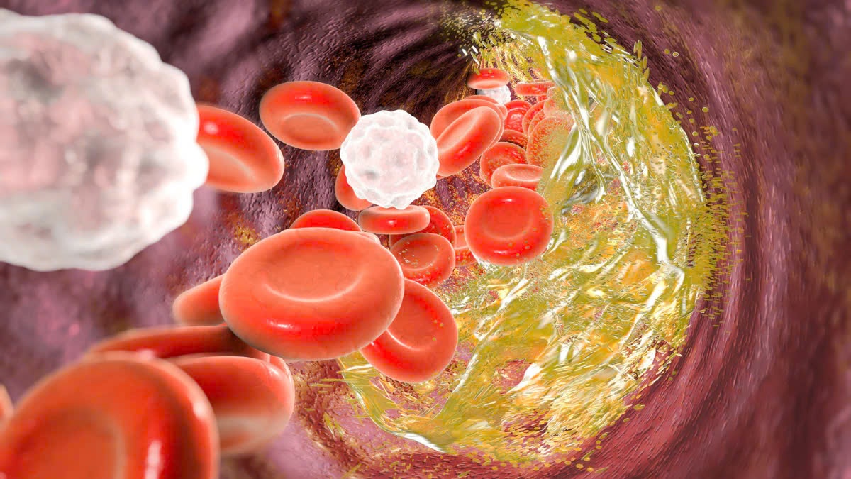 Cach giam mo mau tu nhien hinh anh