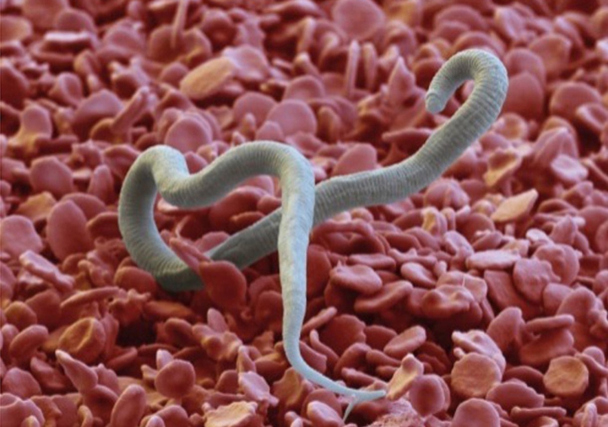 Cau hoi thuong gap ve nhiem giun chi hinh anh