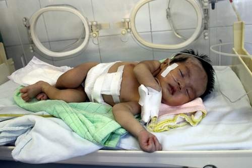 Be gai co noi tang lech lac dang nguy kich hinh anh