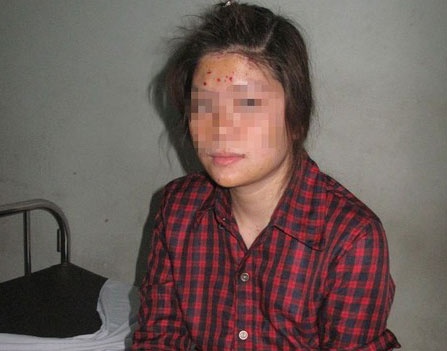 Lan manh moi nguoi chuyen goi buu pham gay phat no hinh anh