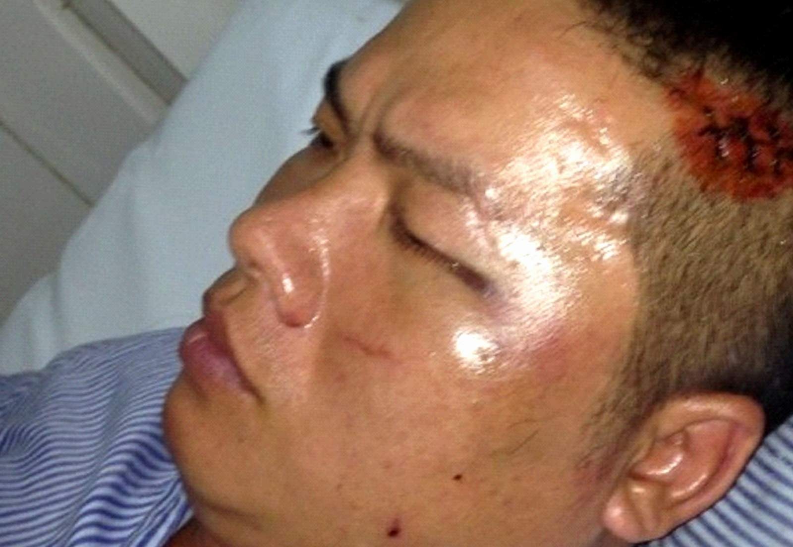 Bat ke dung sung khi di du tiec o dat Cang hinh anh