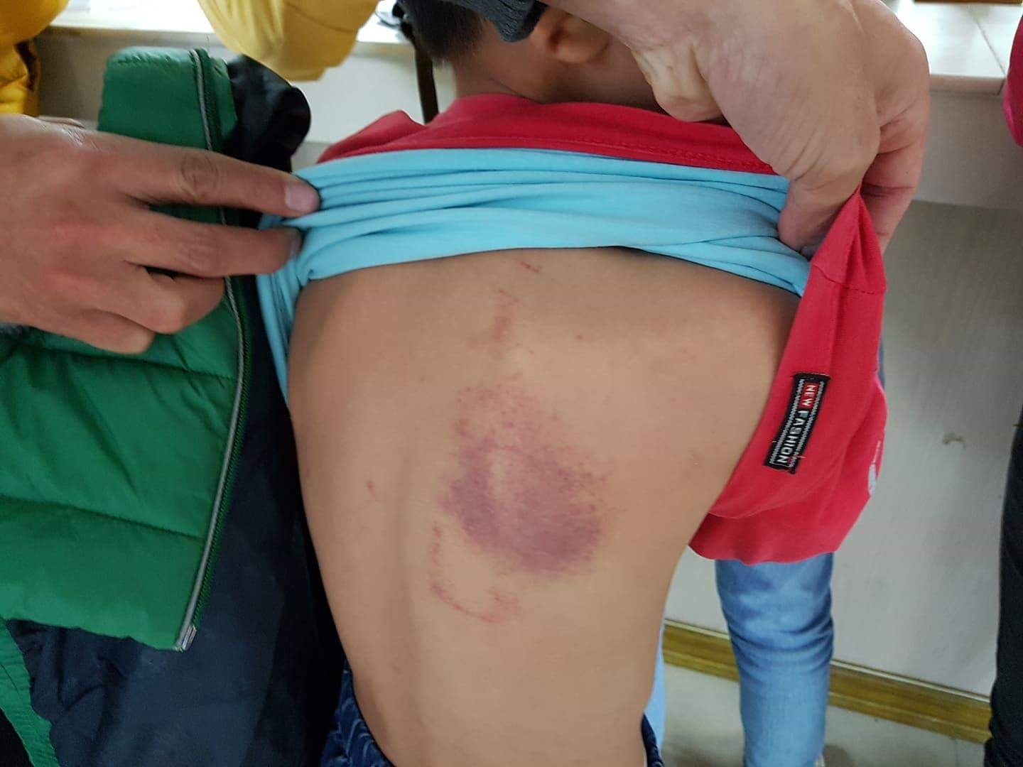 Co giao thua nhan dung thuoc ke danh bam tim lung hoc sinh lop 2 hinh anh