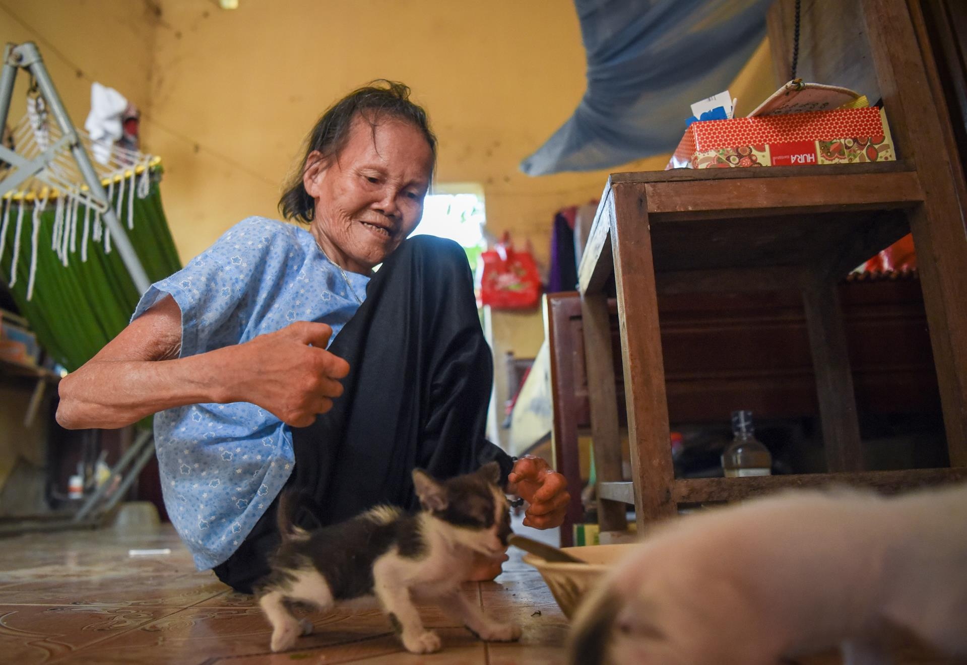 benh phong cui anh 20