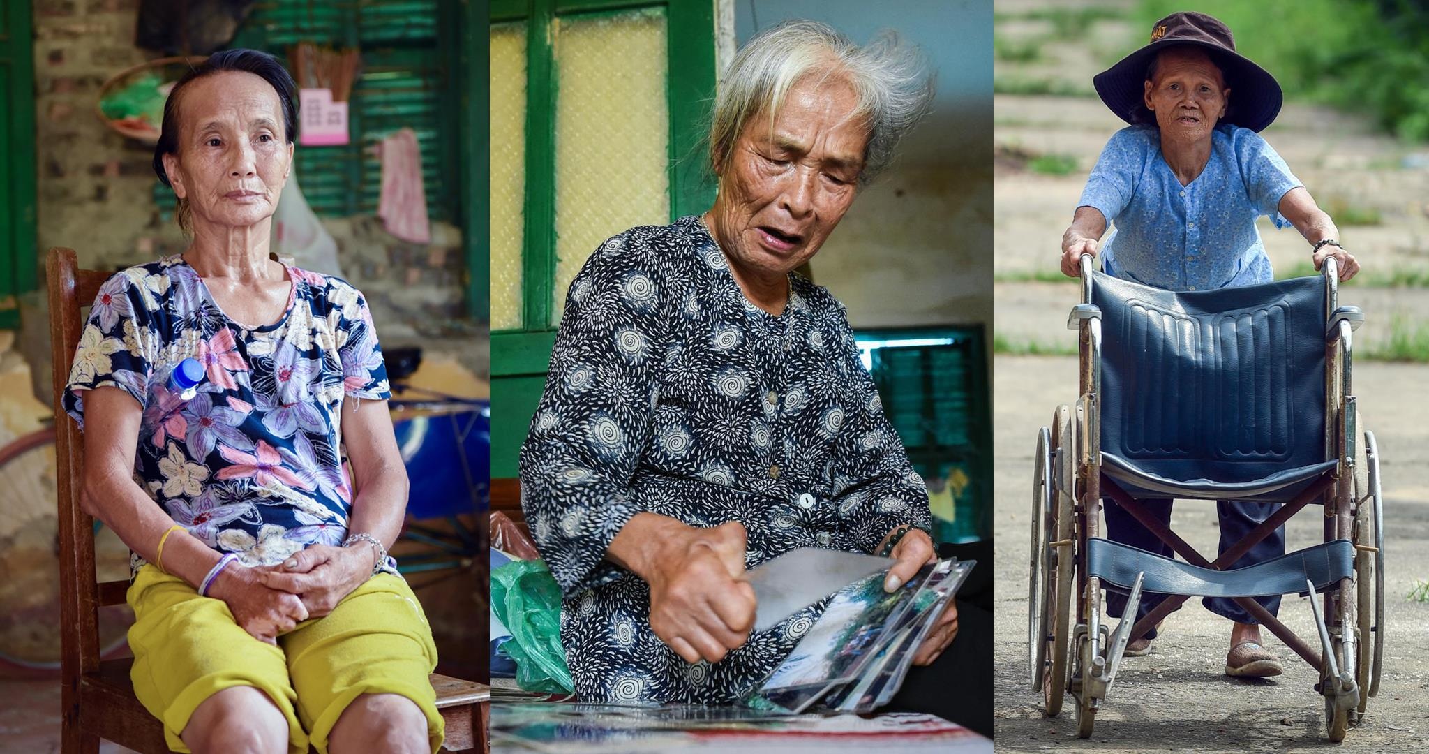 benh phong cui anh 1