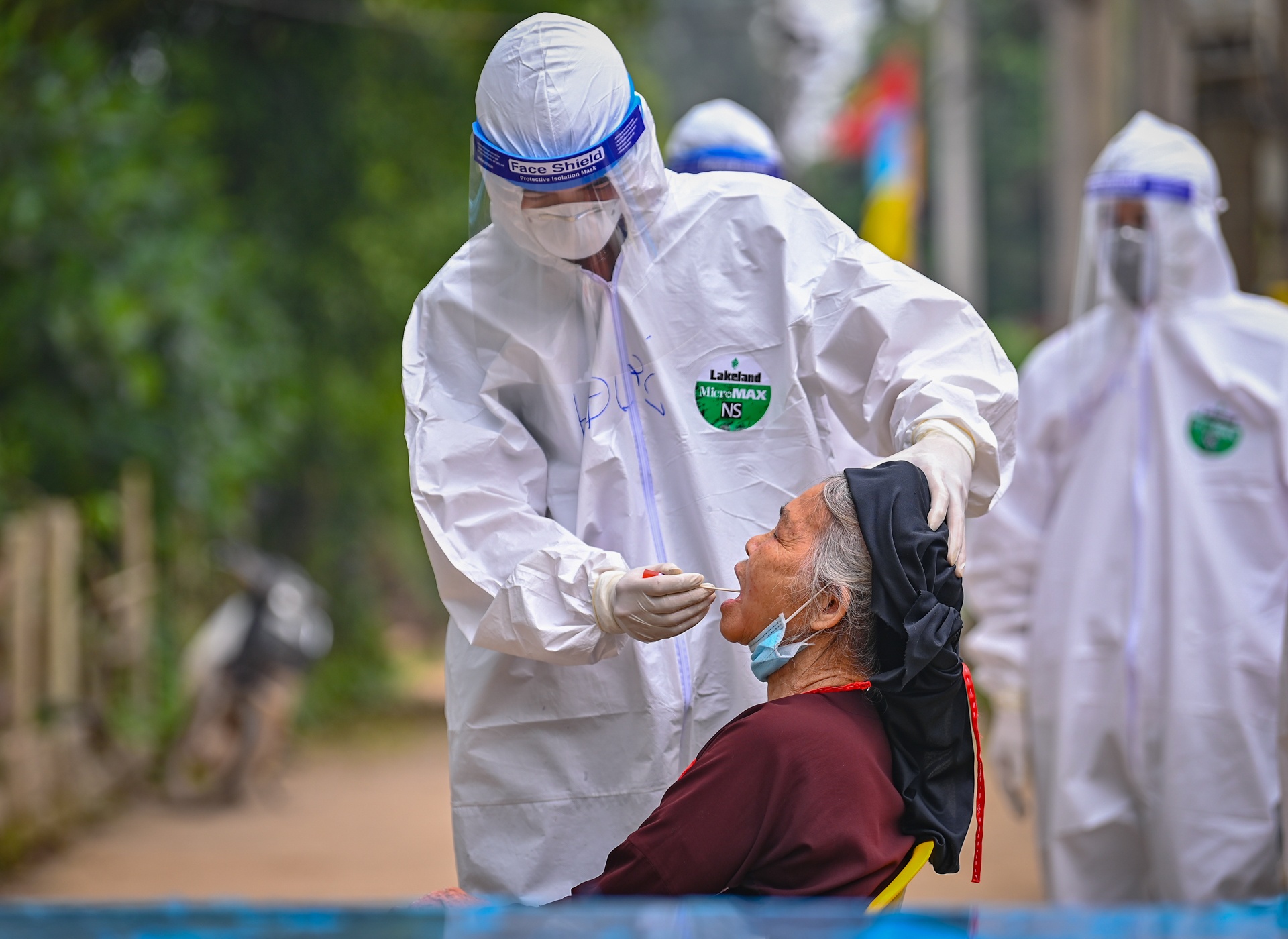 xet nghiem o dich ha loi anh 5