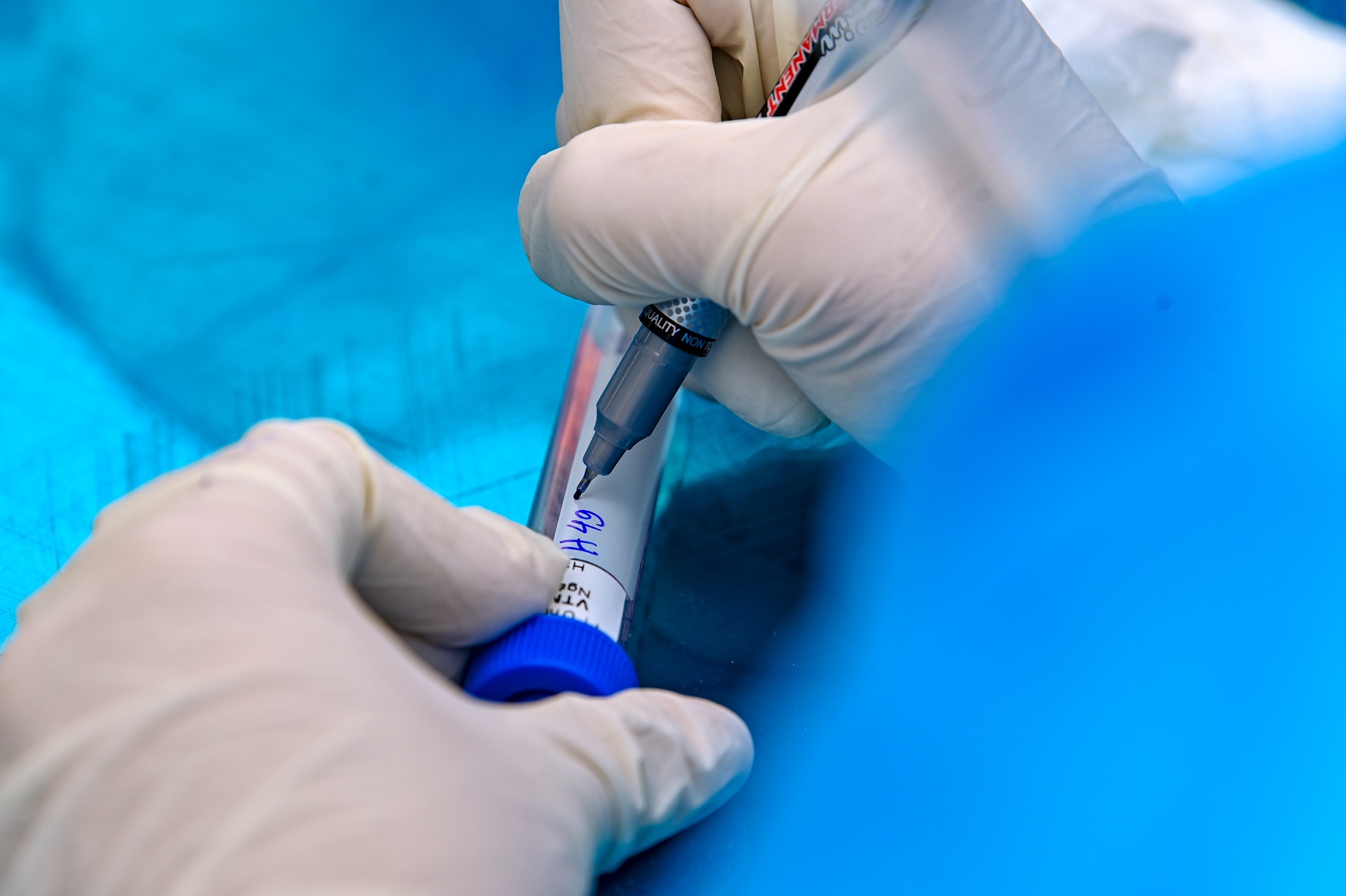 xet nghiem o dich ha loi anh 8