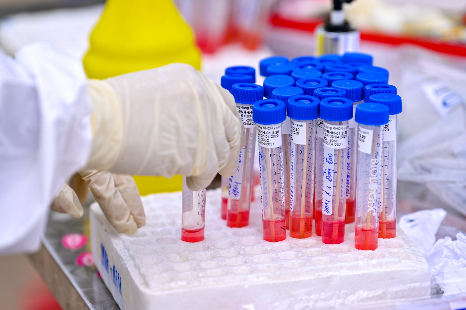 xet nghiem o dich ha loi anh 9