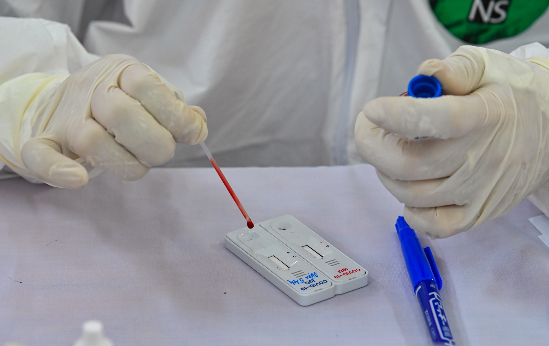 xet nghiem tai cho dau moi long bien anh 8